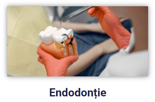 Endodontie refacut 1