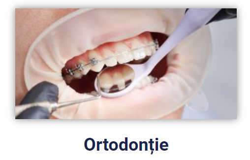 Ortodontie refacut 1